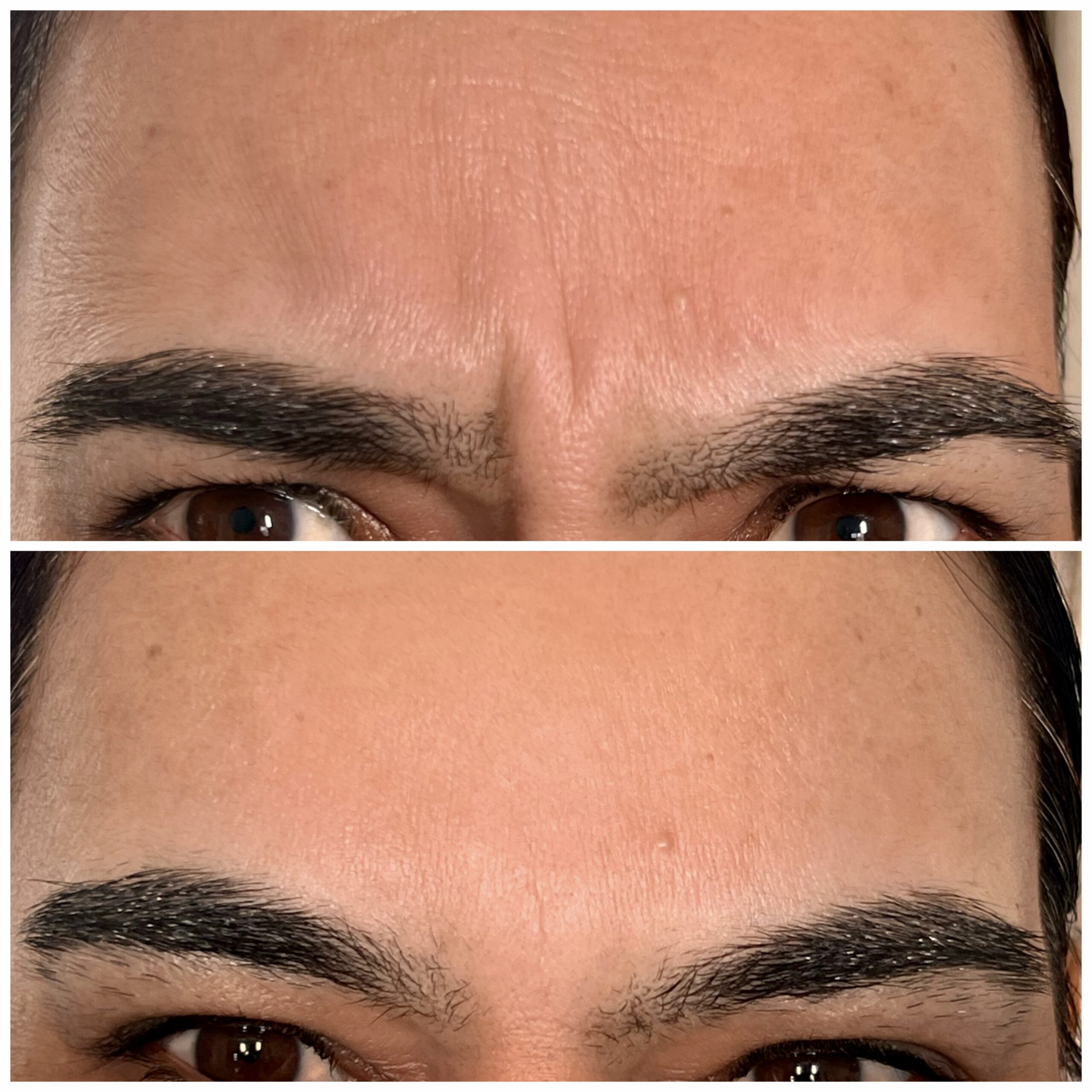 Treatment result