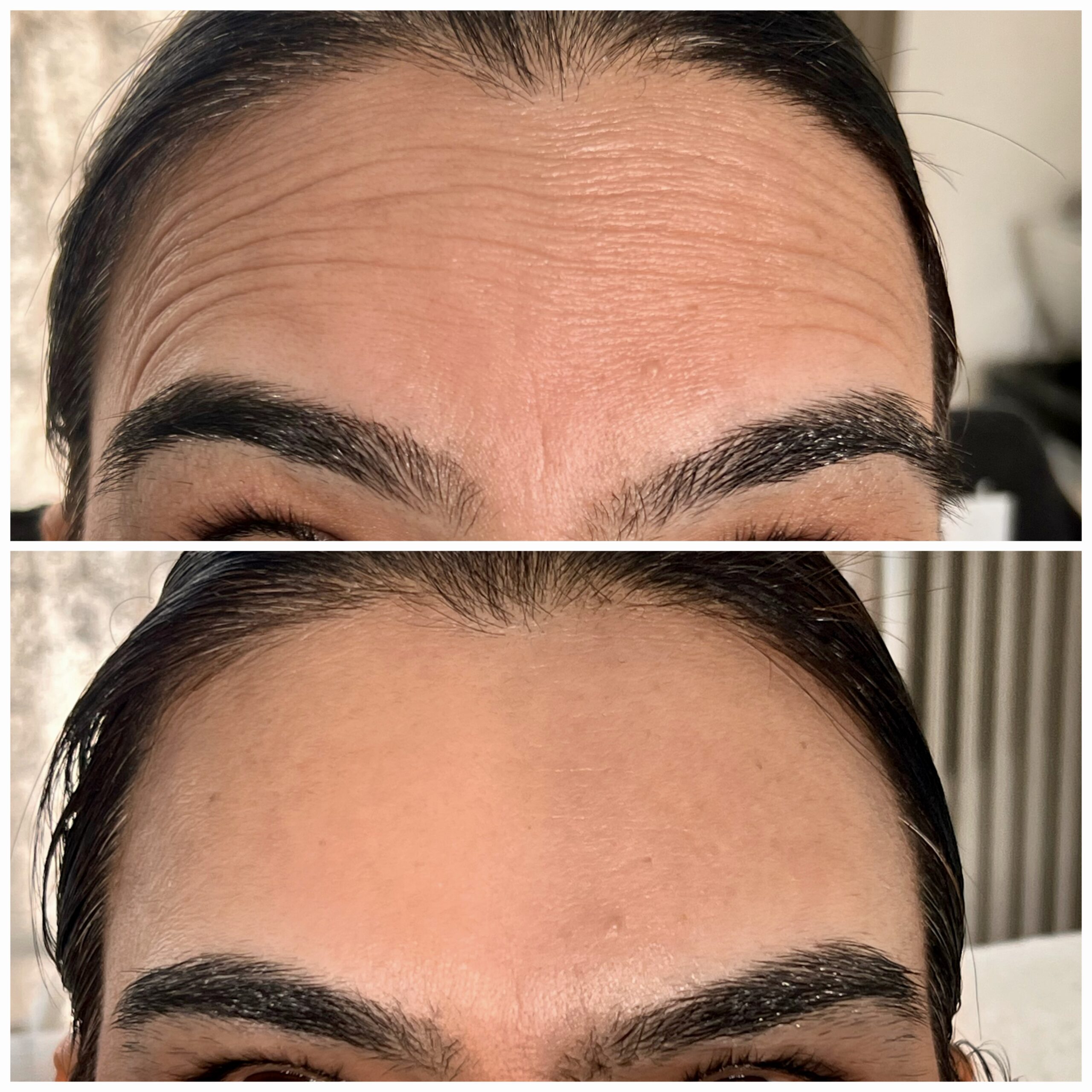 Treatment result