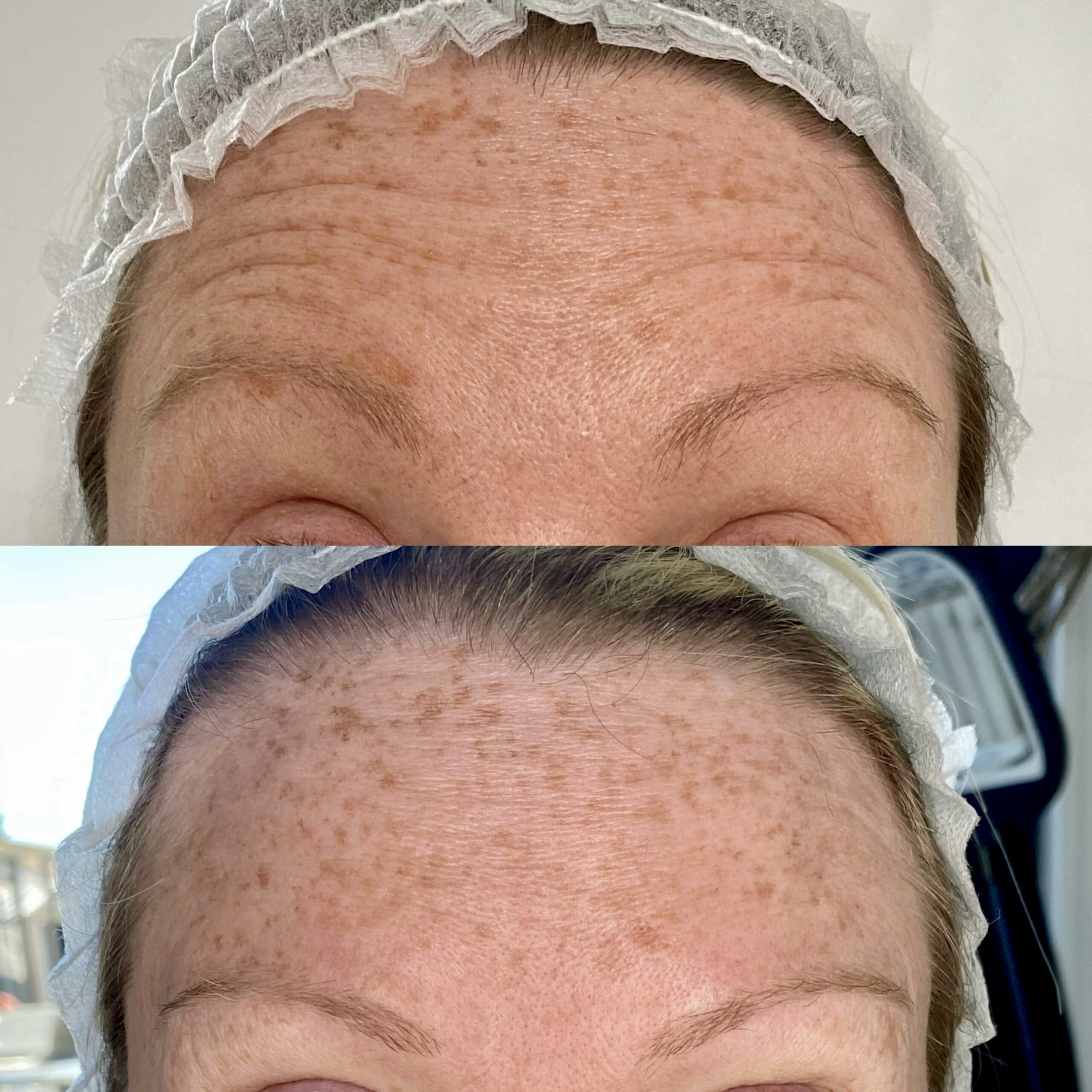 Treatment result