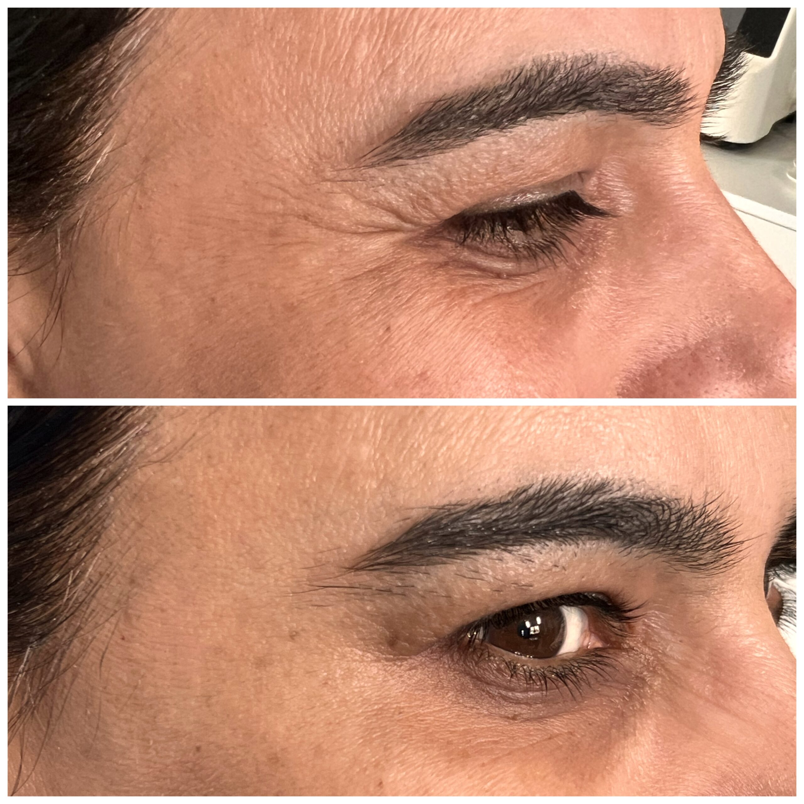 Treatment result