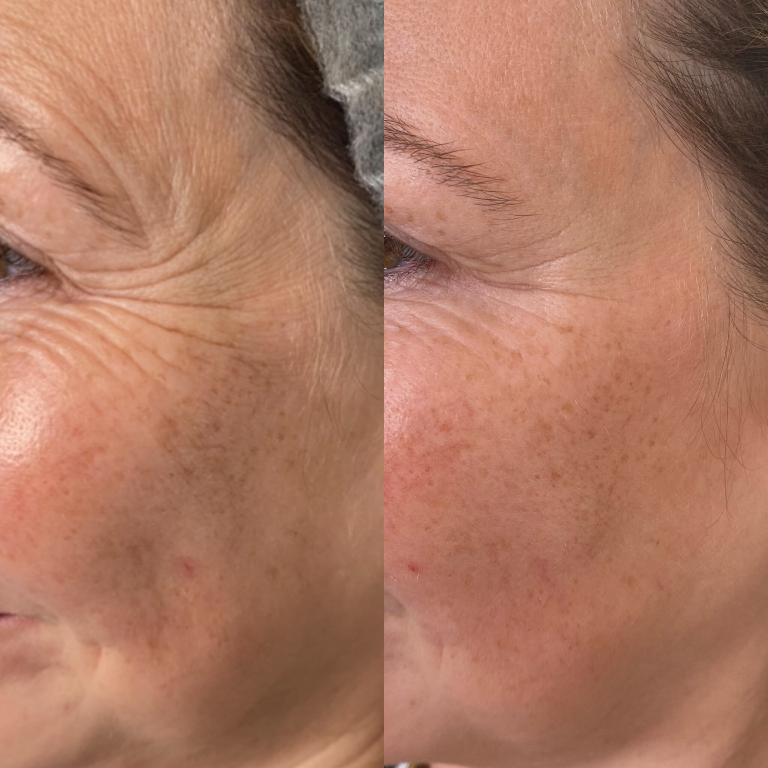 Treatment result