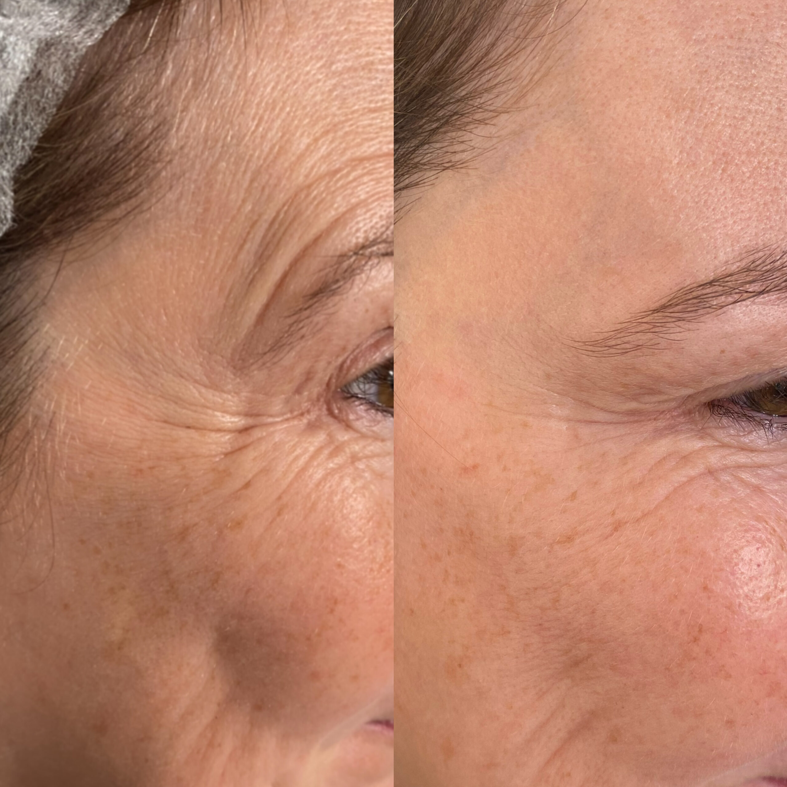 Treatment result