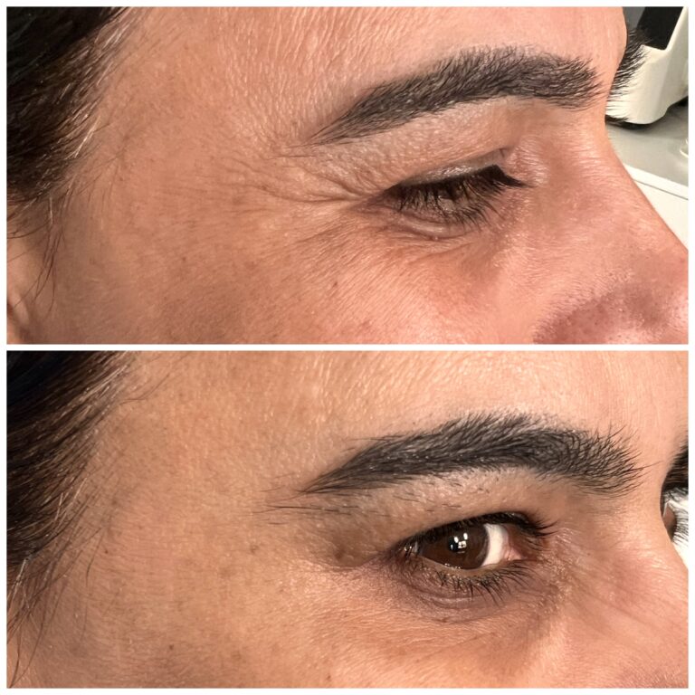Treatment result