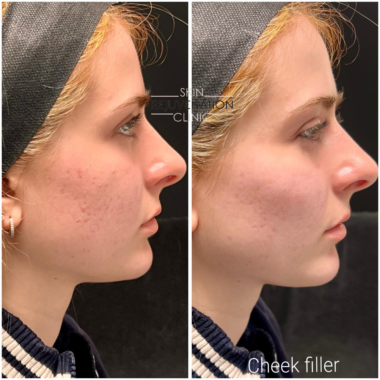 Treatment result