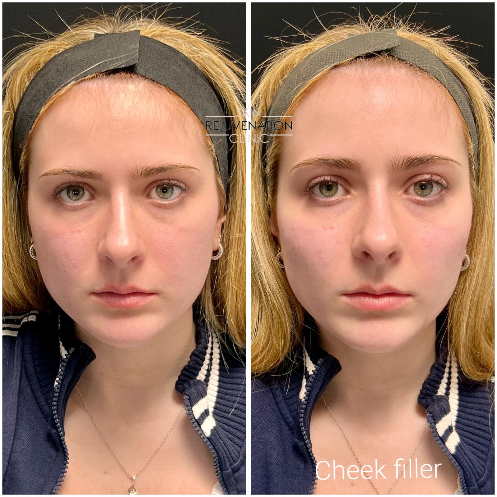 Treatment result