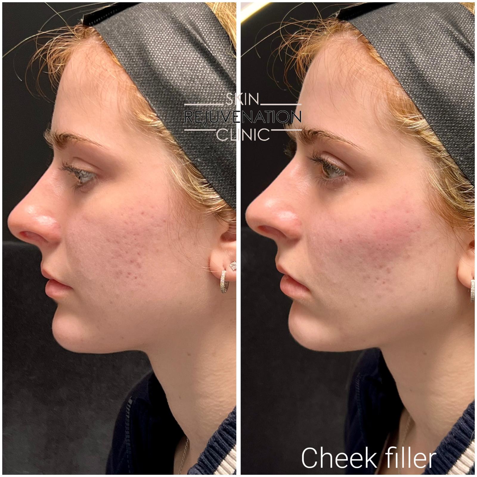 Treatment result
