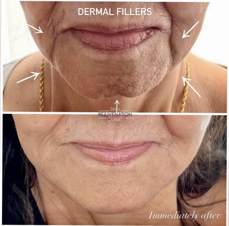 Treatment result