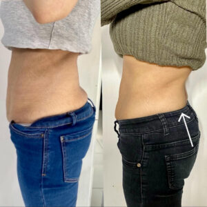Treatment result