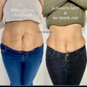 Treatment result