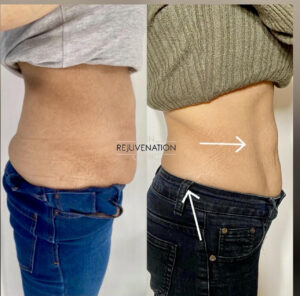 Treatment result