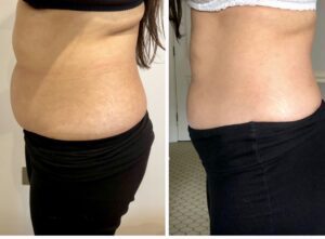 Treatment result
