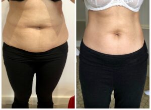 Treatment result