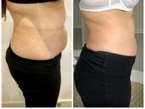Treatment result