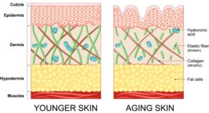 HIFU non-invasive treatment depth chart