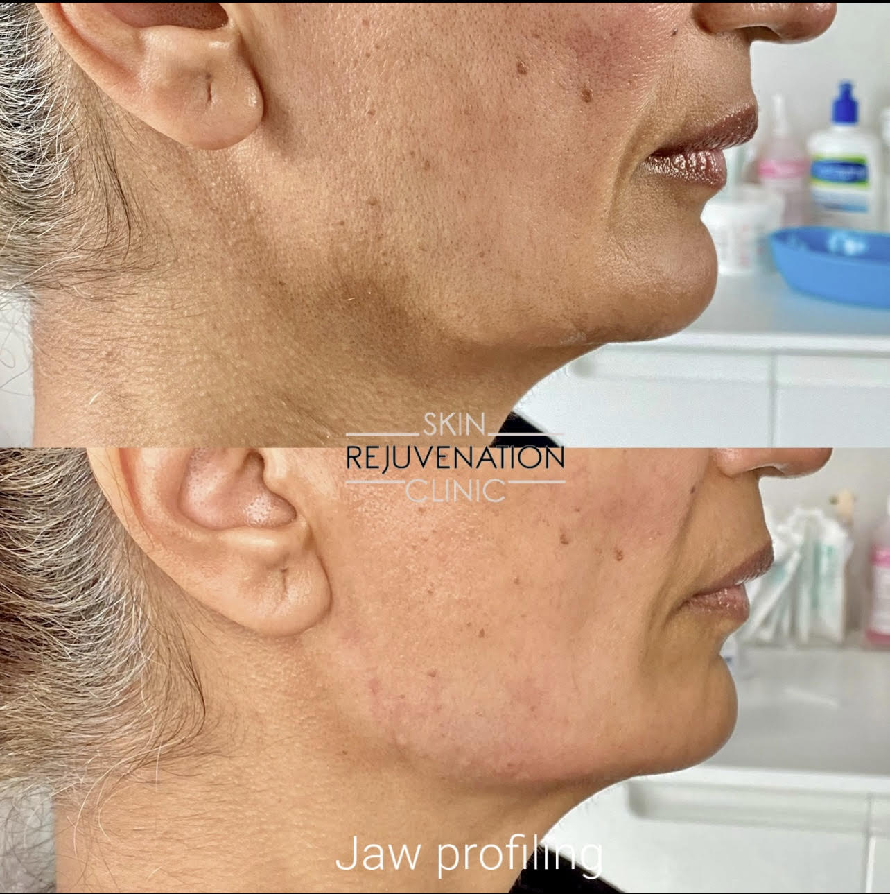 Treatment result