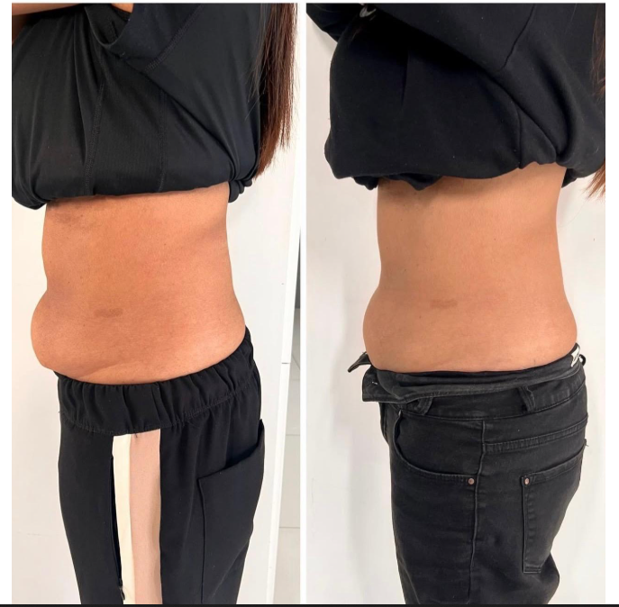 Treatment result