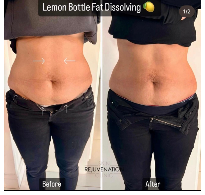 Treatment result