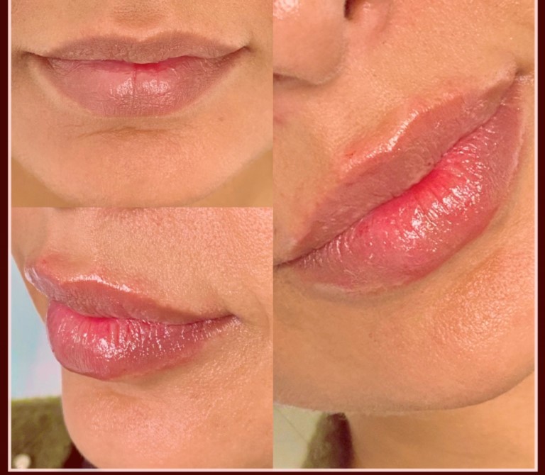 Treatment result