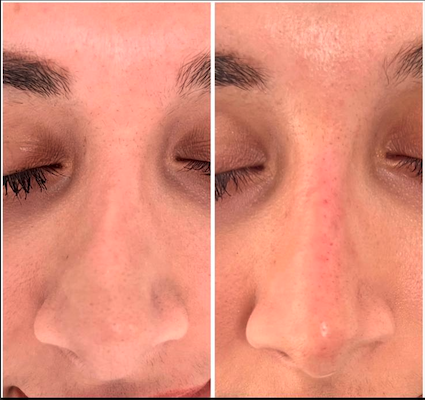Treatment result