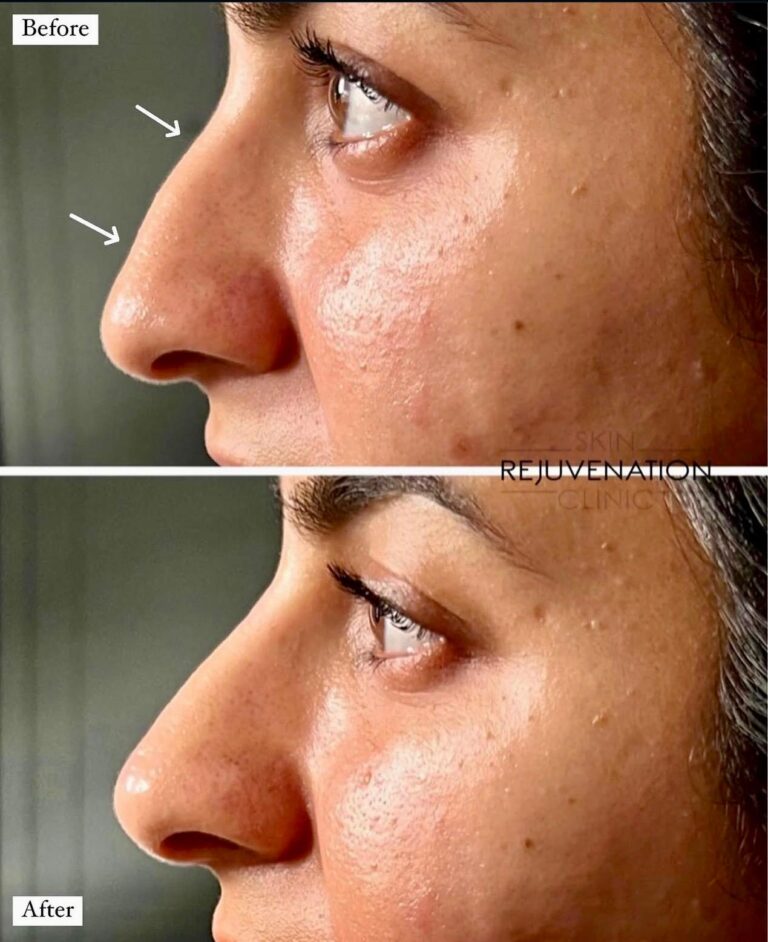 Treatment result