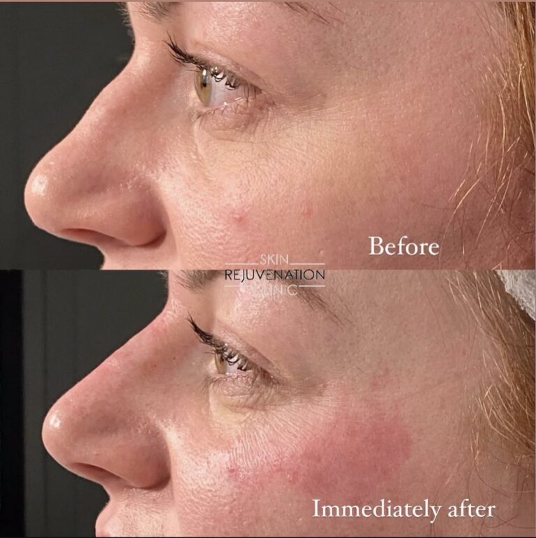Treatment result
