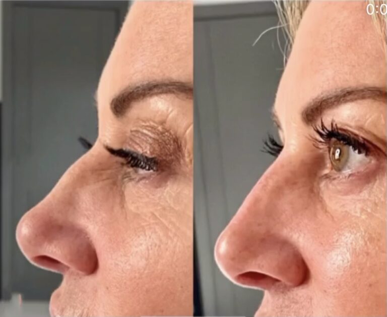 Treatment result