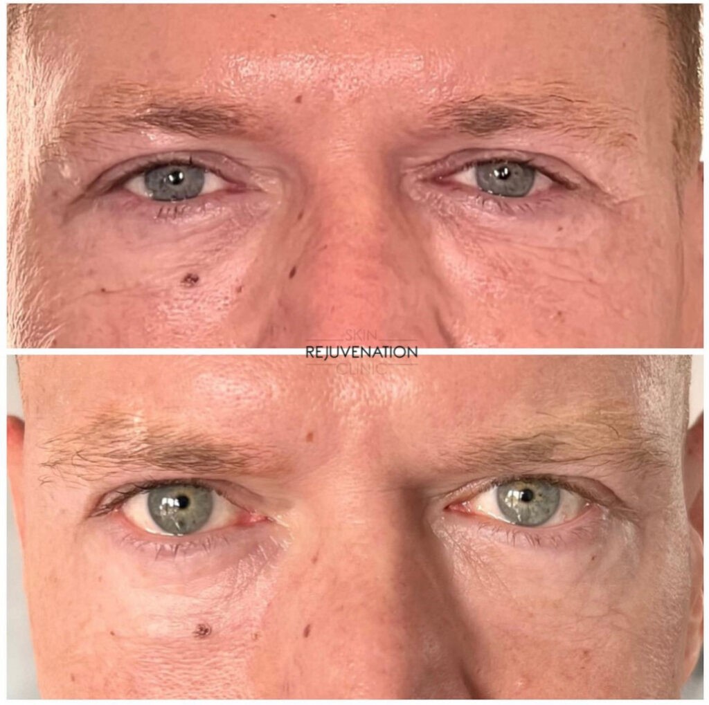 Treatment result