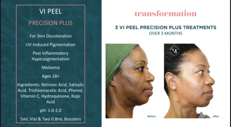 Treatment result