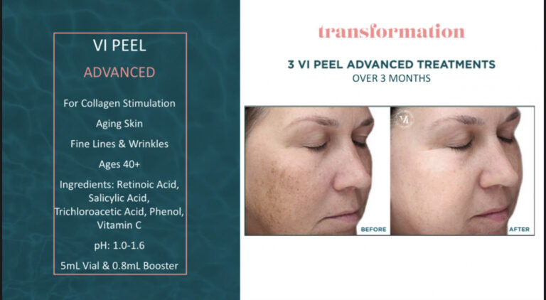 Treatment result