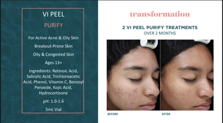 Treatment result