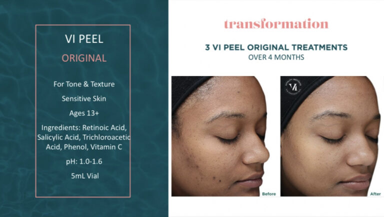 Treatment result